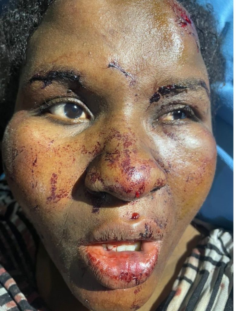 Housewife injure