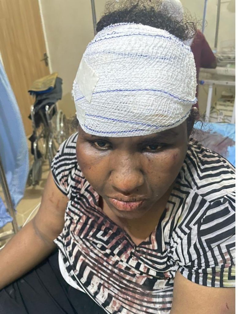 Housewife injured