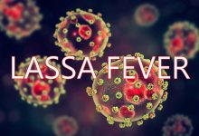 Lassa fever