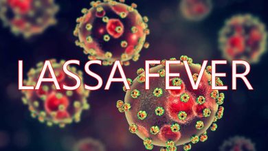 Lassa fever